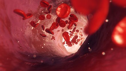 Film 3D – Hématologie