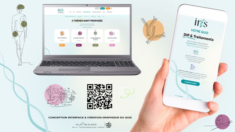 QUIZ iris – DIP & Traitements